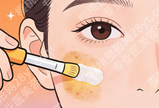 南昌皮秒祛斑的费用一般是多少?一次多少钱看完心里就有数
