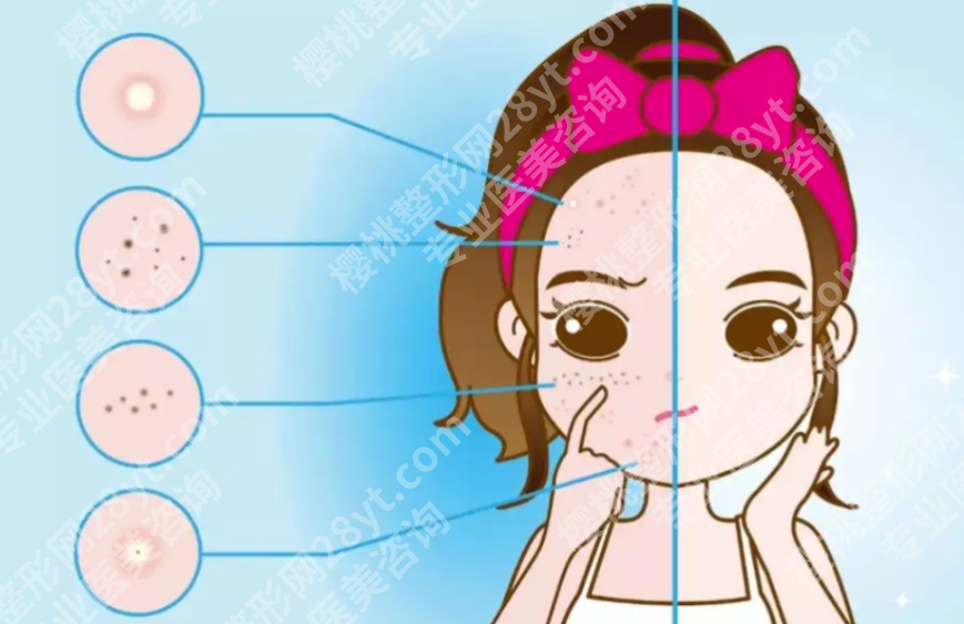 乌鲁木齐点阵激光好的医院有哪些?设备和医生经验都很关键