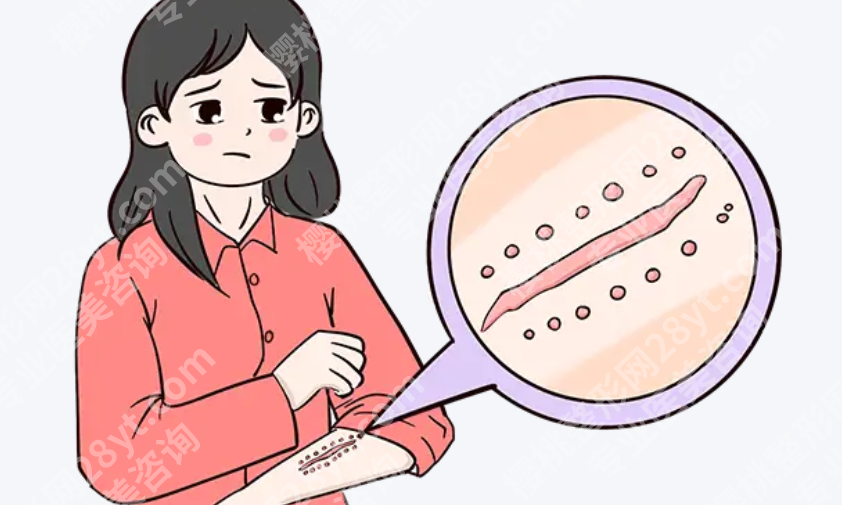 九江去疤痕好的医院排名参考｜激光、疤痕修复怎么挑｜收藏这份就够了