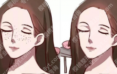 深圳皮秒激光祛斑的价格是多少？从医院报价到疗程预算，这篇讲得很明白
