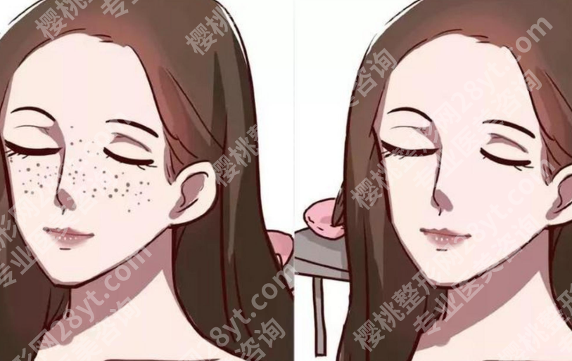 深圳皮秒激光祛斑的价格是多少?从医院报价到疗程预算,这篇讲得很明白