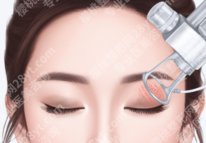 长沙哪里可以做皮秒去眼线？医院资质、恢复期、费用全盘点