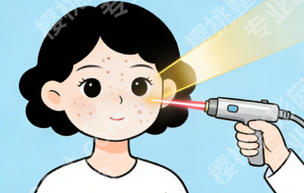温州哪里做皮秒祛斑好？看设备、看医生、看案例才不踩坑