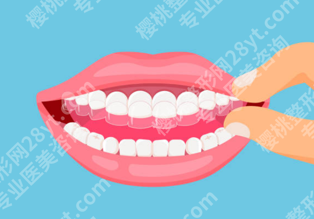 南充牙齿矫正哪个医院好？本地口碑、医生技术、价格对比一次看明白