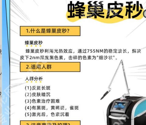 青岛哪个医院做蜂巢皮秒效果好？医院指南来袭！
