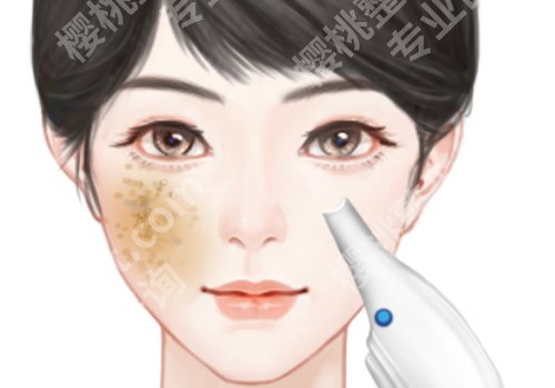 温州三甲医院有做超皮秒的吗?温医二院/温医一院等院实力测评