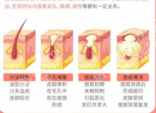 曲靖祛痘哪家医院好？排名榜单公布这些医院榜上有名