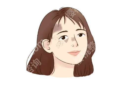 吉大一院激光祛斑怎么样?张维、刘姗姗、王望舒医生各有专攻、收费公开