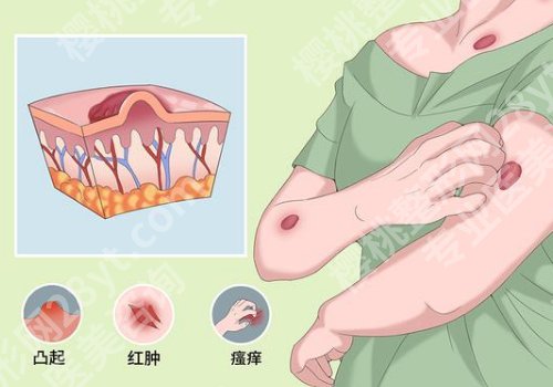 咸阳去除疤痕哪家好？当地热门医院盘点、祛疤必看指南！