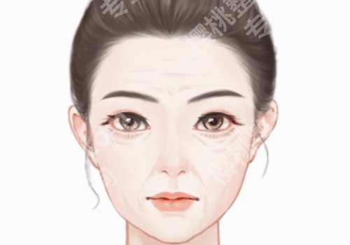 成都去皱纹哪一家医院好？华西医院/省人民医院/八大处等推荐