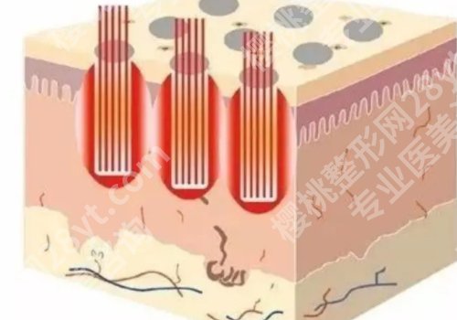贵阳做点阵激光好的医院有哪些?医科大附院/省人民医院等曝光