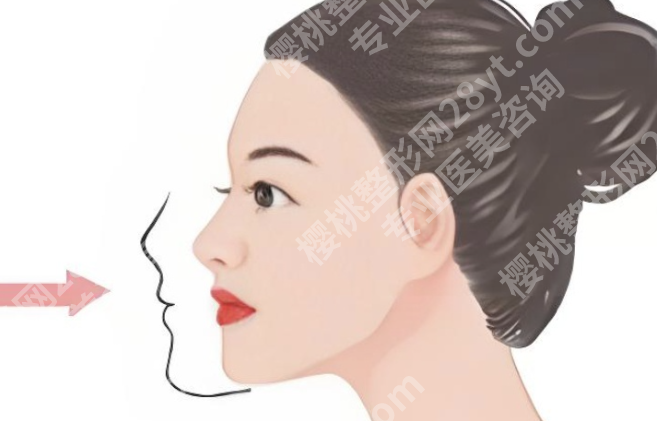 北京下颌骨医生哪家好？从面诊到方案，内行人这样判断