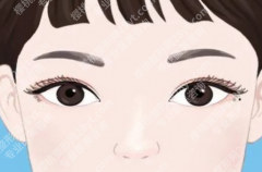 北京双眼皮整形手术的医院怎么选？想要自然款眼睛先看这篇
