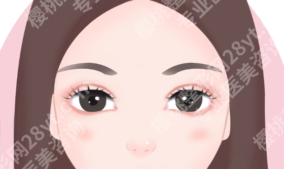 北京双眼皮修复医院排行参考,失败眼修复前建议先做功课
