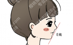 上海下巴整形前五医院排名参考，重点看轮廓设计和医生稳定性
