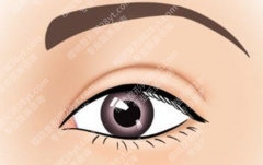 上海眼整形医院排名怎么看？双眼皮、开眼角、眼袋项目全梳理