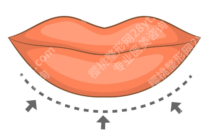 上海做嘴唇排名的医院怎么选？厚唇改薄、M唇、唇裂修复都不同