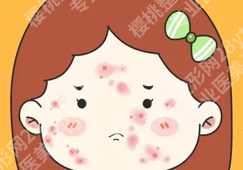 佛山祛痘机构哪里好？一文了解多家热门医院、这几家藏不住了！