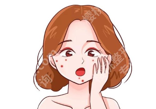 湖州点阵激光医院排名！详情与pk，轻松获得好肌肤