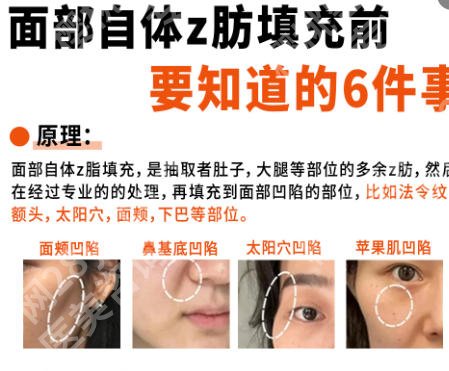 西安注射填充好的医生有哪几位？何志、王本锋等医生人气高