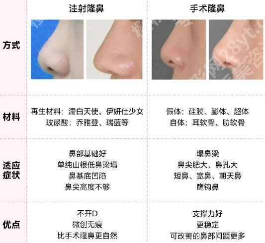 太原注射隆鼻专门整形医院名单揭晓!正规机构名单更新!
