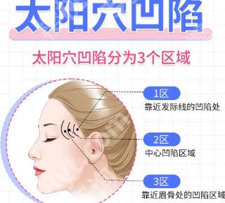 西安注射医生张新成简历分享！玻尿酸填充技术如何？案例点评