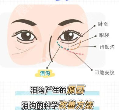 武汉填充泪沟好的医院有哪几家？2026热门整形机构口碑排行