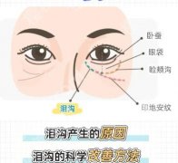 嘉兴填充泪沟有几种方法？方法盘点！含推荐医院