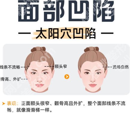 长沙脂肪填充哪家医院好？人气医院名单出炉！点击收藏
