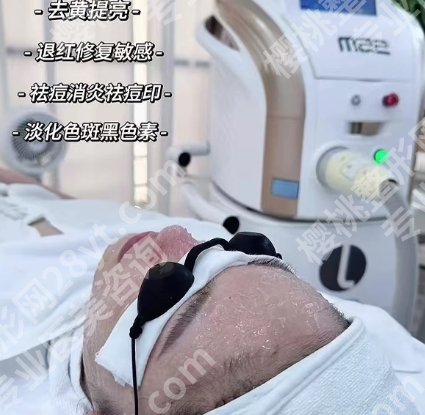 重庆西南医院光子嫩肤价格表更新！光子嫩肤1千5起！2026价格解析
