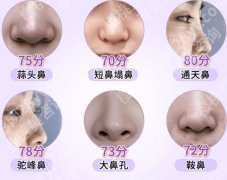 上海第八人民医院假体隆鼻怎么样？2026收费标准更新！含技术点评