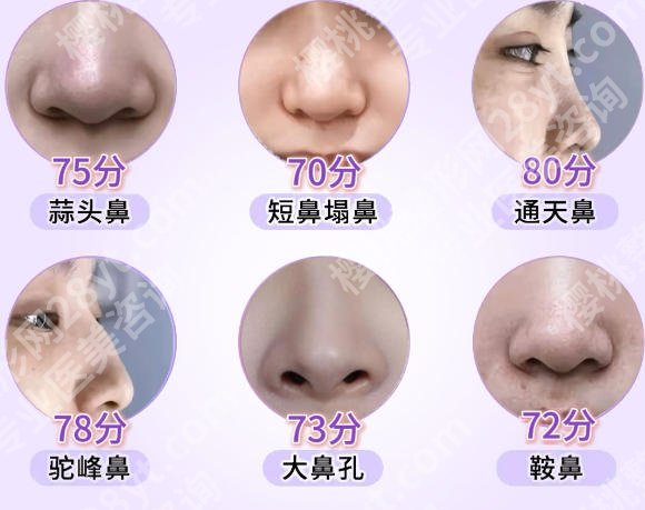 上海第八人民医院假体隆鼻怎么样？2026收费标准更新！含技术点评