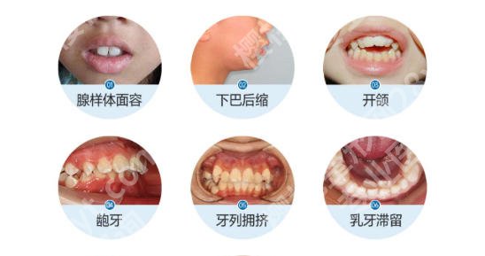 六安人民医院牙科医生名单公布！王世霞、孙辉、汤玉龙风格太自然！