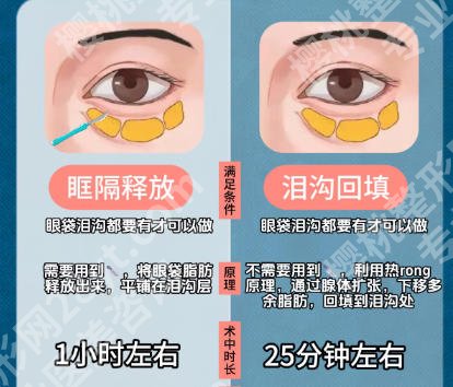 上海填充泪沟哪家医院好？上海九院、中山医院皆上榜！