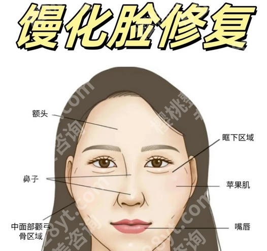 邓正军注射物取出效果怎么样？价格贵不贵？2026收费细节公布！