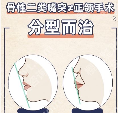 柳州市人民医院正颌技术咋样？项目优势剖析！含真实口碑