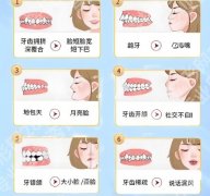 绍兴人民医院正畸科哪个医生好？陈敏、余国建医生备受好评！