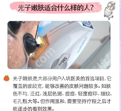 广州华侨医院光子嫩肤价格贵不贵？费用低至1200左右！