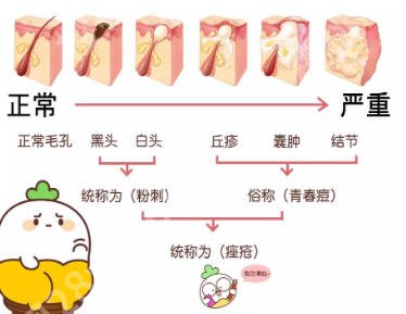 宁波第一医院点阵激光多少钱？祛痘坑2k-3k不等！含热门项目