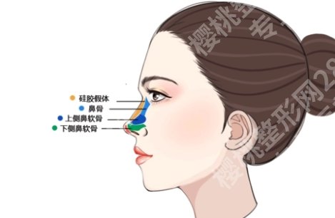 上海第一人民医院整形外科怎么样?鼻整形案例及术后注意事项分享!