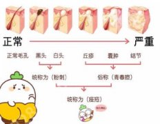 深圳北大医院点阵激光医生名单揭晓！于波、胡小平口碑在线！