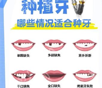 河源人民医院口腔科好不好?牙齿矫正案例参考!附详细流程