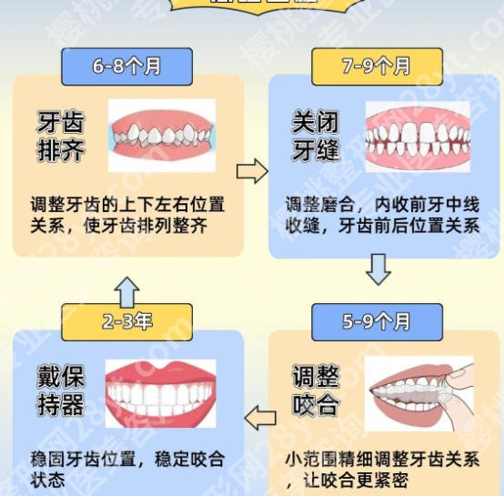 蚌埠二院牙齿矫正技术如何？托槽矫正8k-2w不等！透明收费更放心