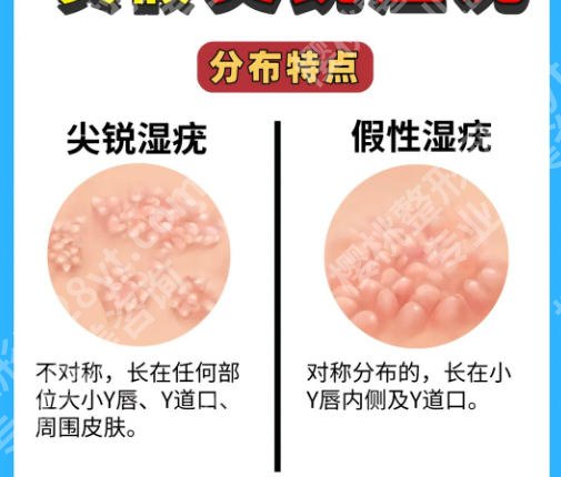 东莞紧缩针多少钱一支？26年top榜单一览