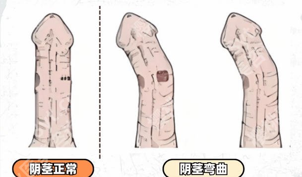 天津增粗增长医院医生名单公布！李莹、姚庆君口碑在线！