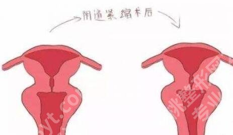 郑州紧缩针哪里可以打啊?2026医院排行榜名单更新!速速码住