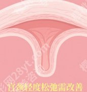 哈尔滨缩紧针哪里有卖？哈医大一院、大二院等性价比之选！
