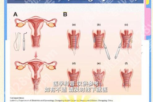 厦门紧缩针多少钱一支哪里可以打？2026年私密整形医院排行榜曝光！