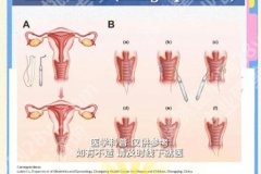 珠海adm紧缩针哪里可以打？2026口碑医院热榜公开！