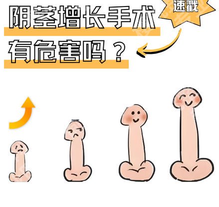 杭州增粗增长医院医生名单揭晓！黄文杰、沈向前口碑好